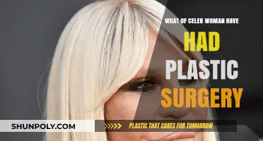 Celeb Women and Plastic Surgery: Who’s Gone Under the Knife?