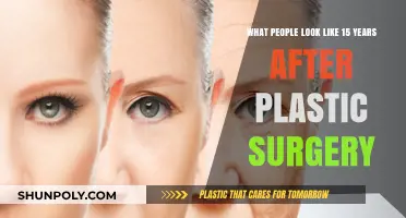 Aging with Enhancements: 15-Year Plastic Surgery Transformations Revealed