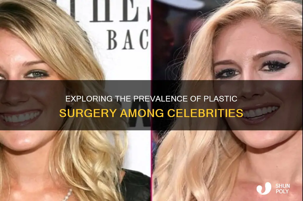 what percent of celebrities get plastic surgery