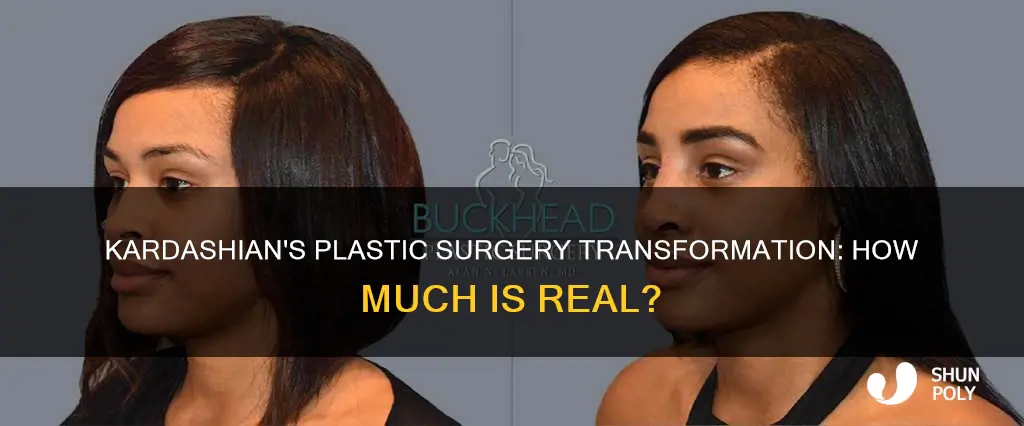 what percent of kim kardashian is plastic