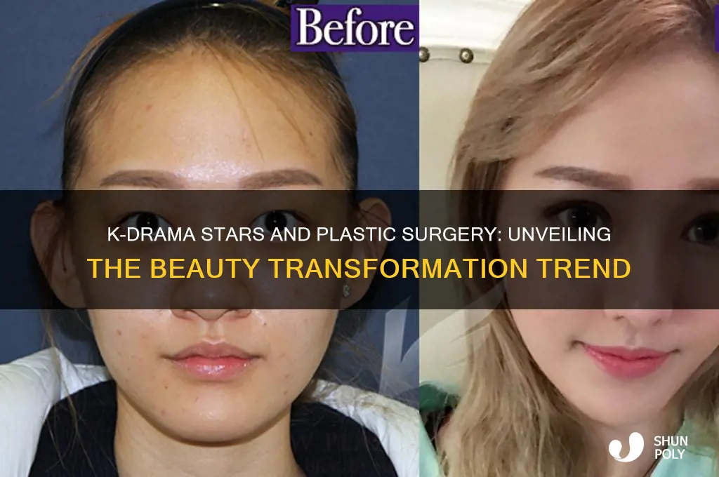 what percentage of kdrama stars have plastic surgery