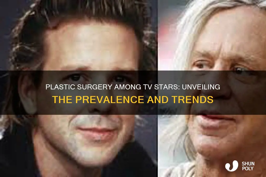 what percentage of tv stars have had plastic surgery