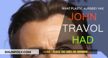 John Travolta's Plastic Surgery Transformation
