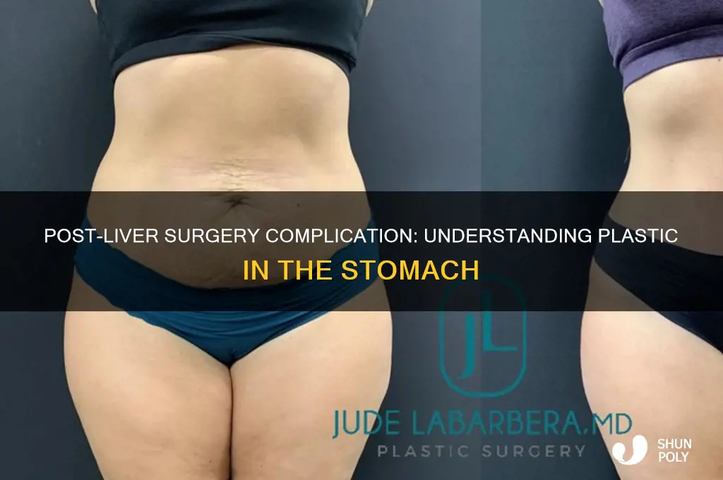 what plastic inside stomach after liver surgery
