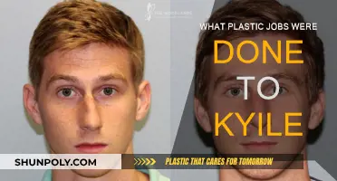 Plastic Surgery Secrets of Kylie Jenner