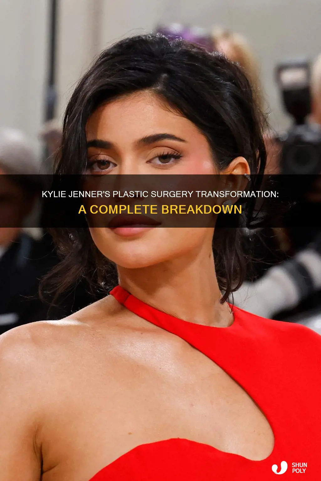 what plastic procedures has kylie jenner had