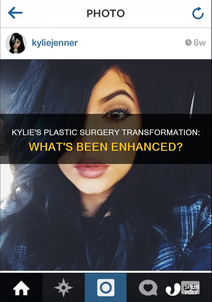 what plastic sugery did kylie have done