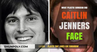 Caitlyn Jenner's Facial Transformation: The Plastic Surgeon Behind Her Look