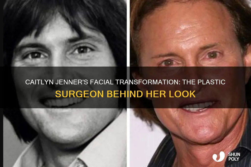 what plastic surgeon did caitlin jenners face