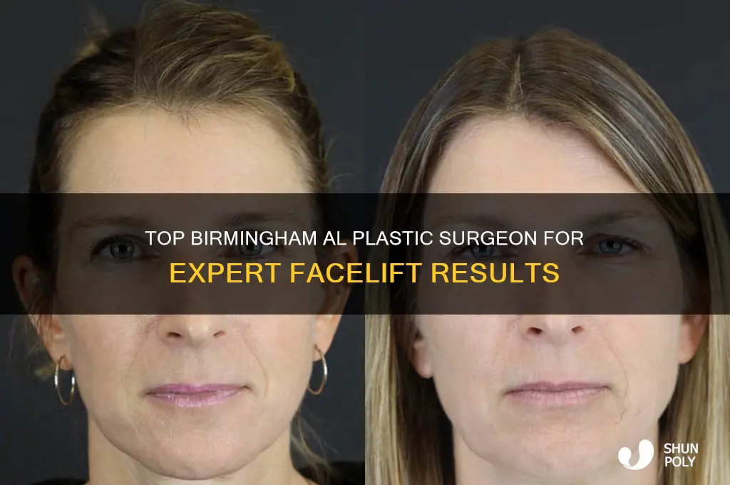 what plastic surgeon in birmingham al does the best rytidectomy