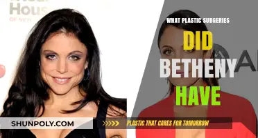 Bethenny Frankel's Plastic Surgery Journey: Procedures and Transformations Revealed