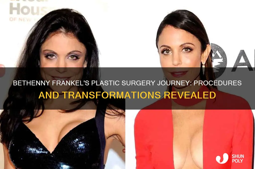 what plastic surgeries did betheny have