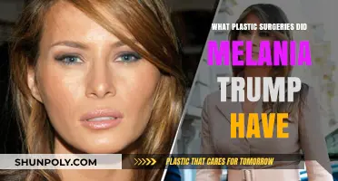 Melania Trump's Plastic Surgery Speculations: Unveiling Her Transformation Journey
