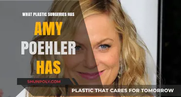 Amy Poehler's Plastic Surgery: Rumors, Facts, and Her Transformation