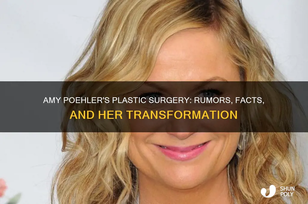 what plastic surgeries has amy poehler has