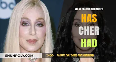 Cher's Transformation: Unveiling Her Plastic Surgery Journey and Procedures
