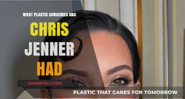 Chris Jenner's Plastic Surgery Journey: Procedures and Transformations Revealed