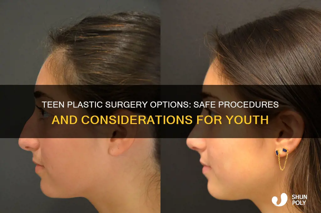 what plastic surgery can teens get