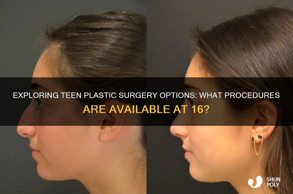 what plastic surgery can you get at 16
