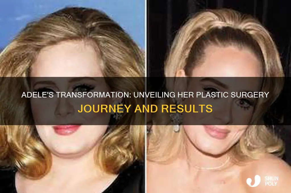 what plastic surgery did adele have
