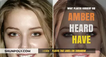 Amber Heard's Plastic Surgery: Unveiling Her Transformative Cosmetic Procedures