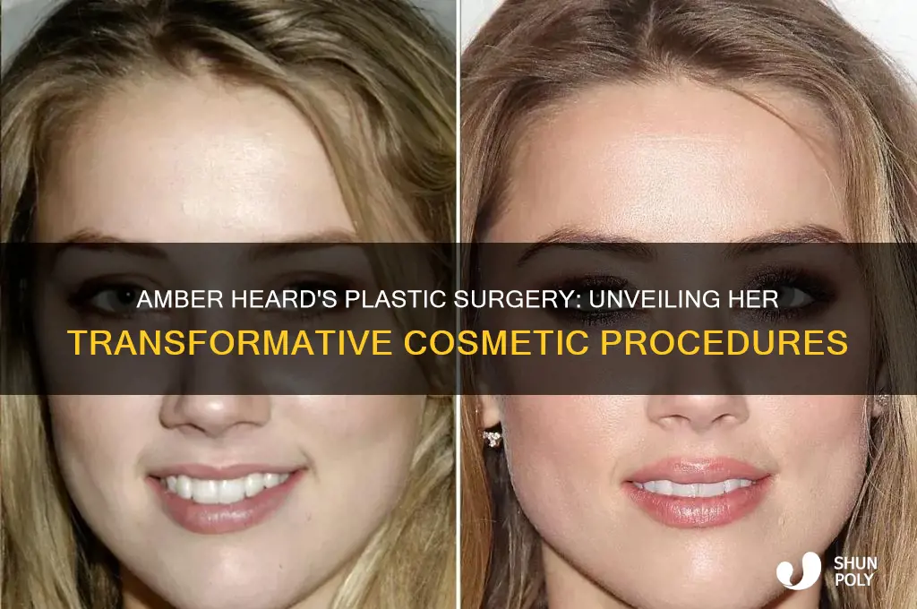 what plastic surgery did amber heard have