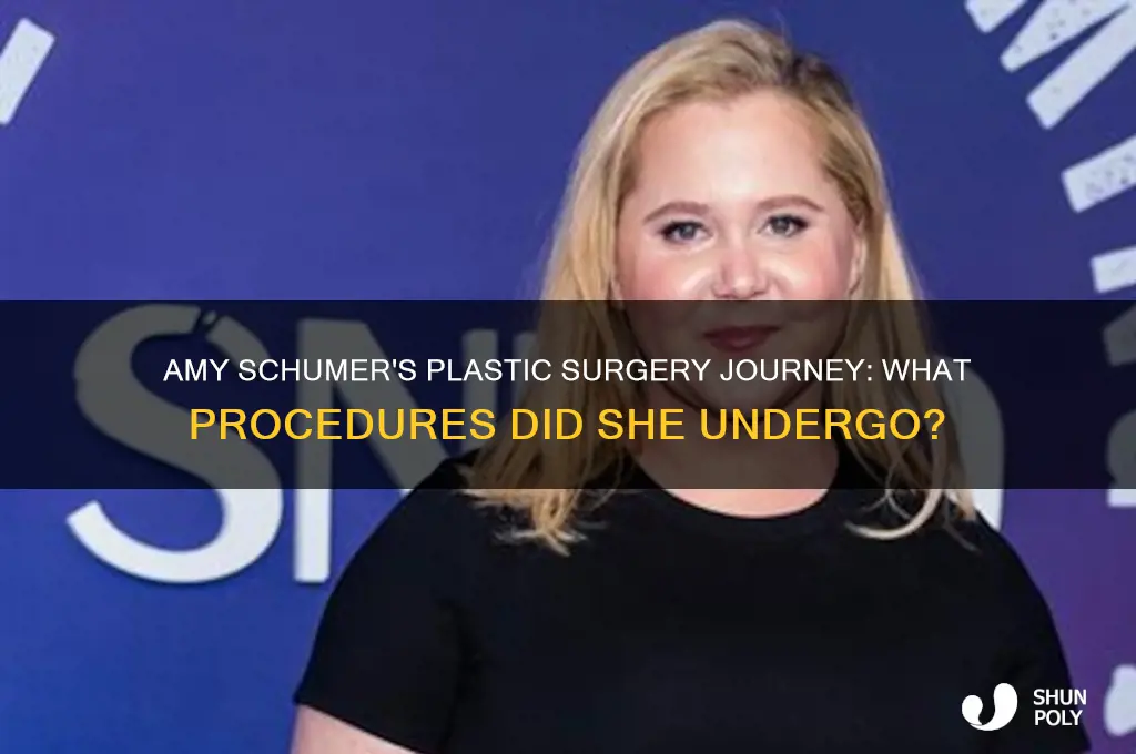 what plastic surgery did amy schumer have
