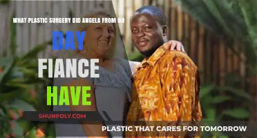 Angela's Transformation: Unveiling Her Plastic Surgery Journey on 90 Day Fiancé