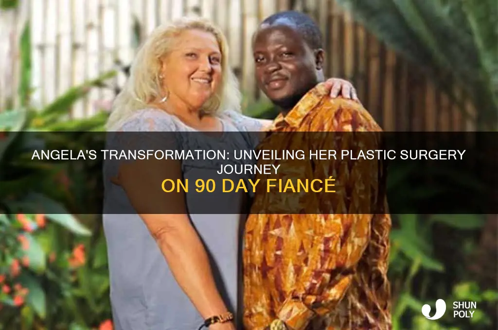 what plastic surgery did angela from 90 day fiance have