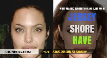 Angelina Jersey Shore Plastic Surgery: Procedures and Transformations Revealed
