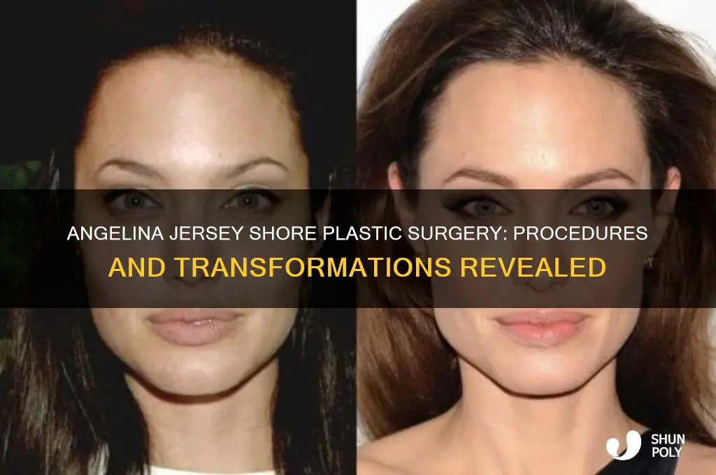 what plastic surgery did angelina from jersey shore have