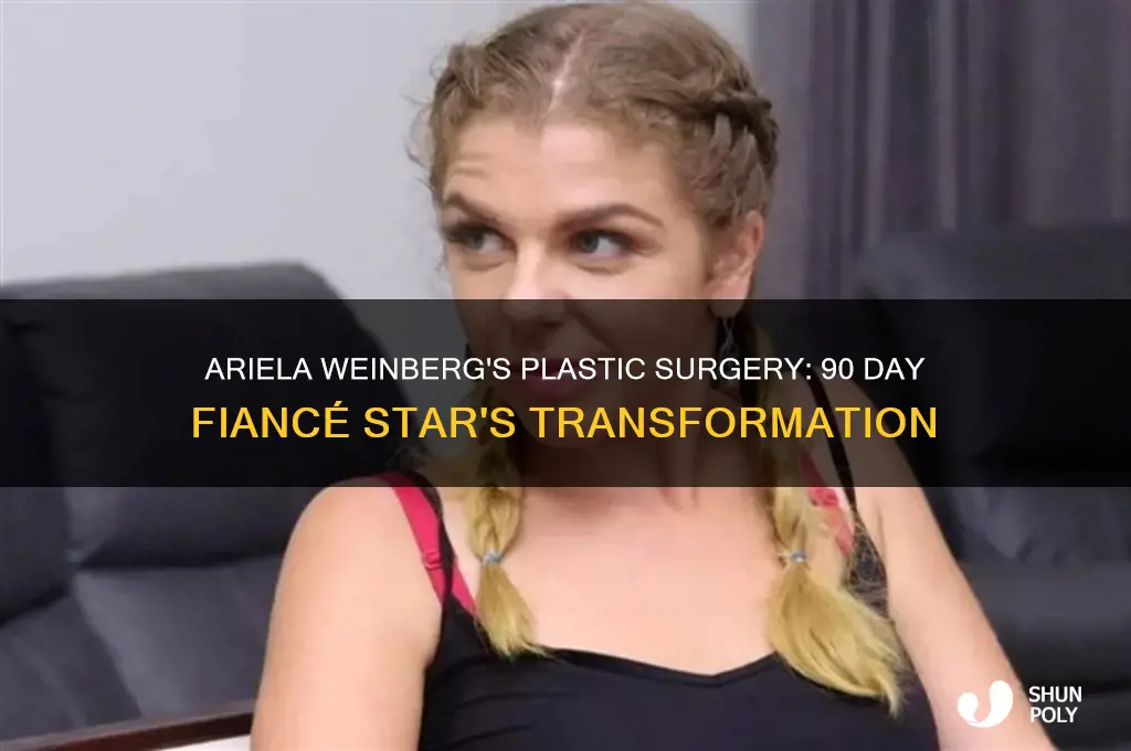 what plastic surgery did ari from 90 day fiance have