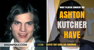 Ashton Kutcher's Plastic Surgery: Rumors, Facts, and Transformations Revealed