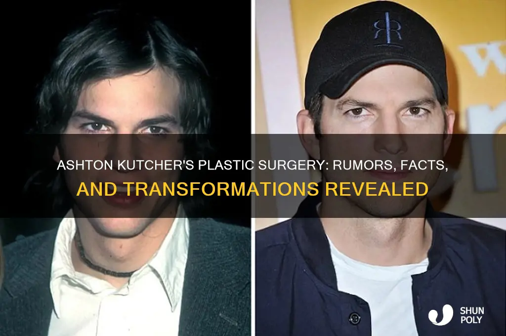 what plastic surgery did ashton kutcher have