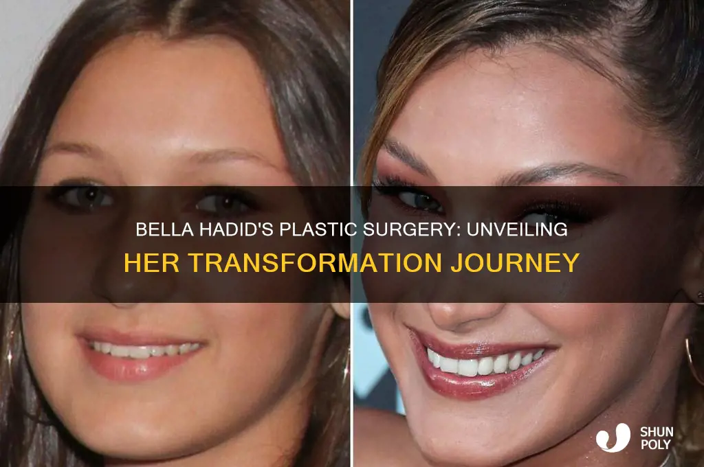 what plastic surgery did bella hadid