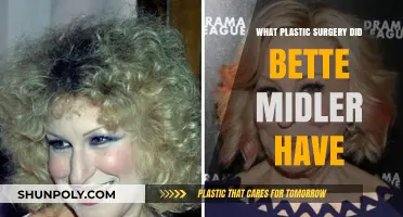 Bette Midler's Plastic Surgery: Unveiling Her Transformation Journey