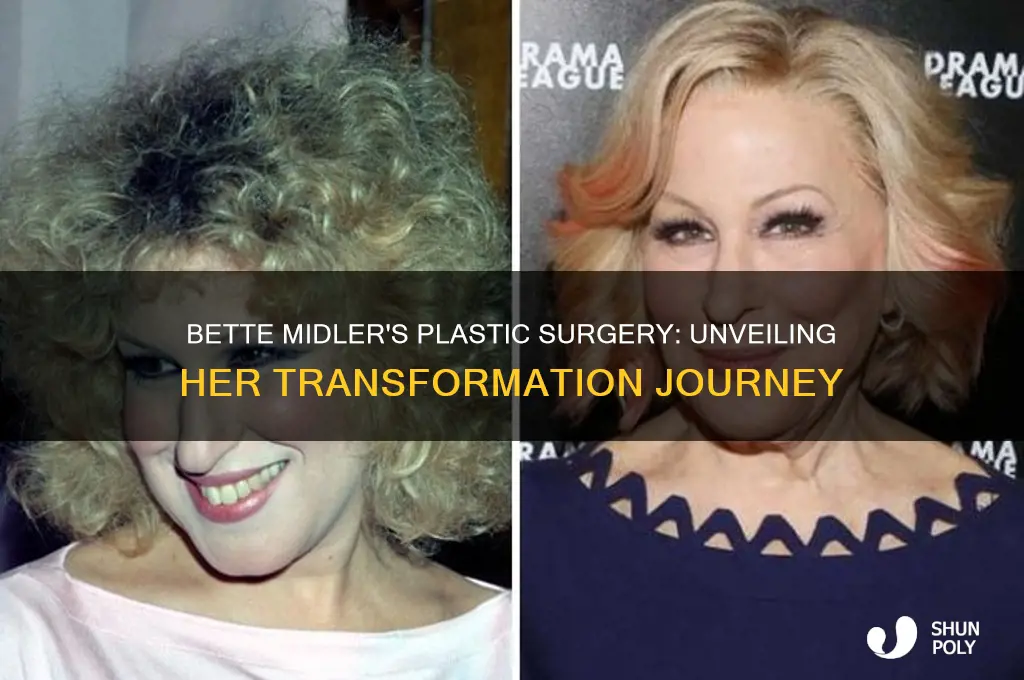 what plastic surgery did bette midler have