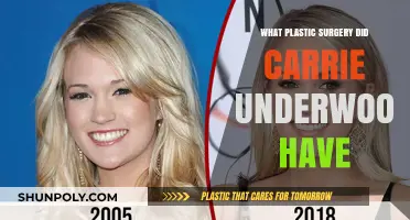 Carrie Underwood's Plastic Surgery: Unveiling Her Transformation Journey