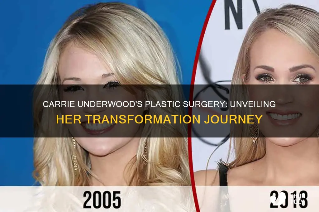 what plastic surgery did carrie underwood have