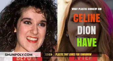 Celine Dion's Plastic Surgery: Unveiling Her Transformation Journey