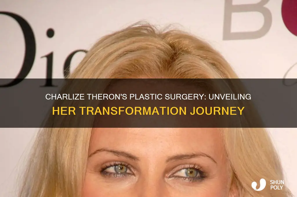 what plastic surgery did charlize theron have