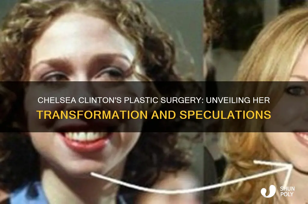 what plastic surgery did chelsea clinton get