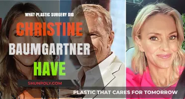 Christine Baumgartner's Plastic Surgery: Rumors, Facts, and Transformations Revealed