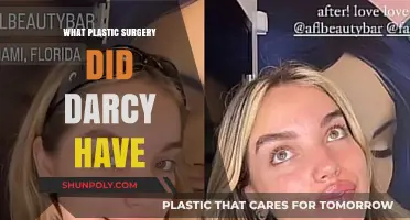 Darcy's Plastic Surgery Transformation: Procedures and Results Revealed