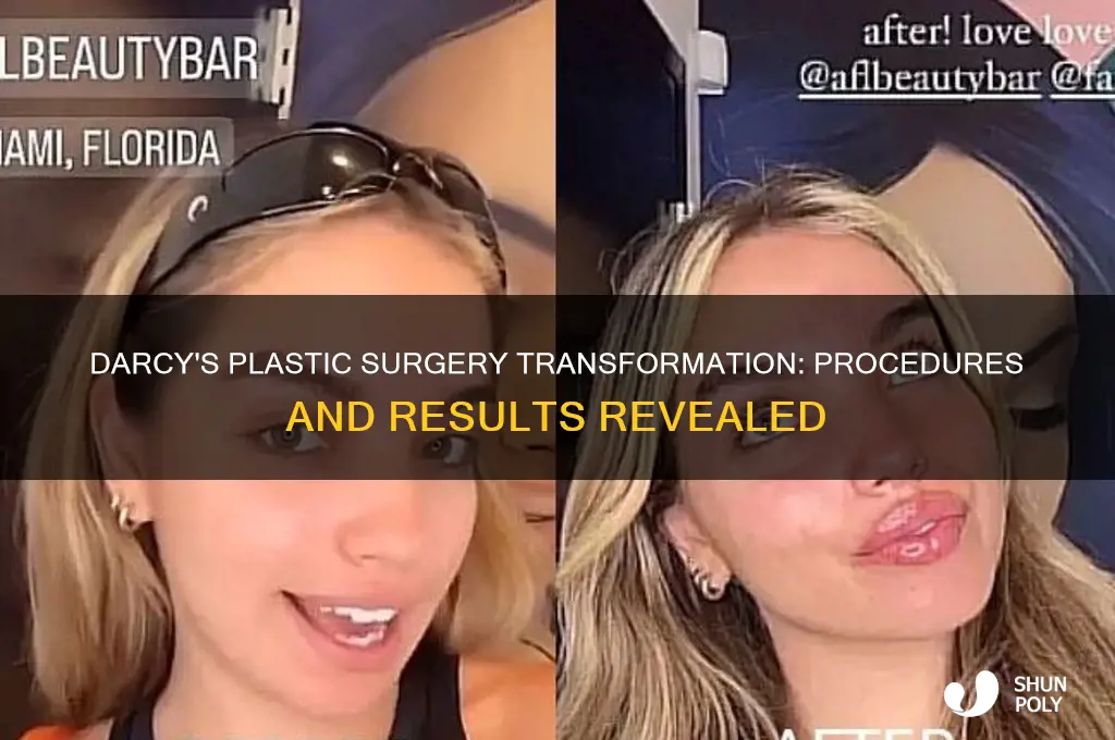 what plastic surgery did darcy have
