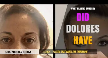 Dolores' Plastic Surgery: Unveiling Her Transformative Cosmetic Procedures