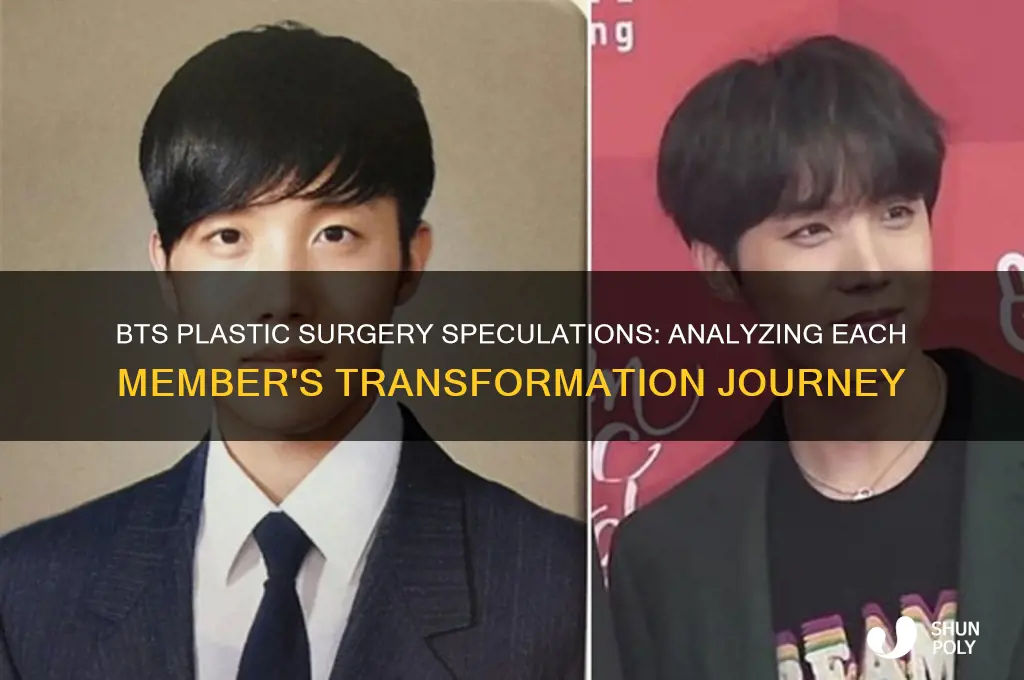 what plastic surgery did each member of bts get