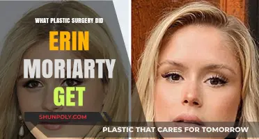 Erin Moriarty's Plastic Surgery: Unveiling Her Transformation and Speculations