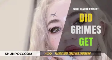 Grimes' Plastic Surgery: Unveiling Her Transformative Cosmetic Procedures