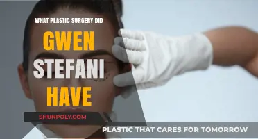 Gwen Stefani's Plastic Surgery: Rumors, Facts, and Transformation